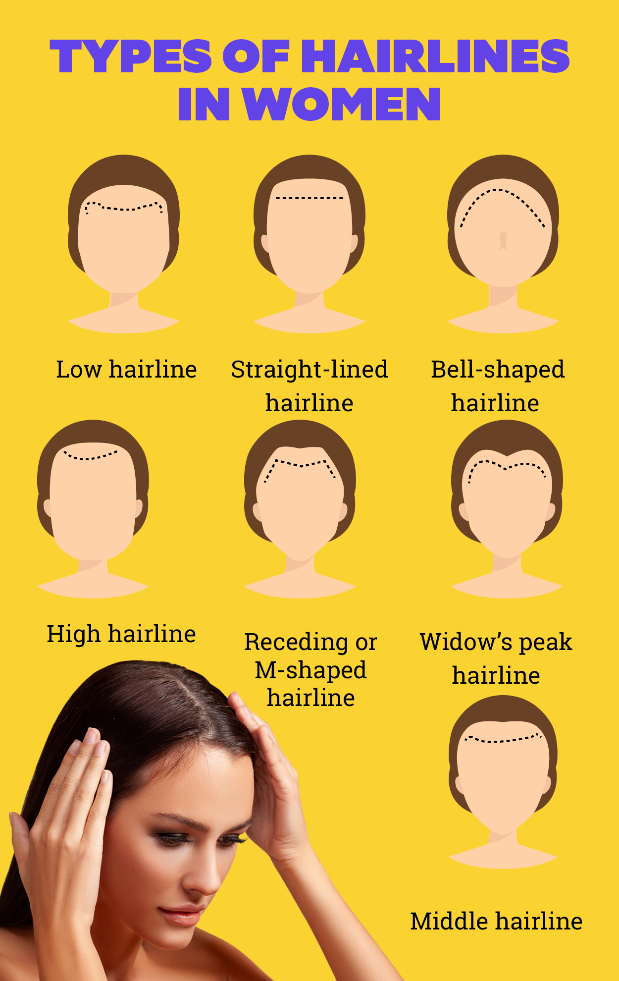 7 types of hairlines and tips to take care of them 1 0